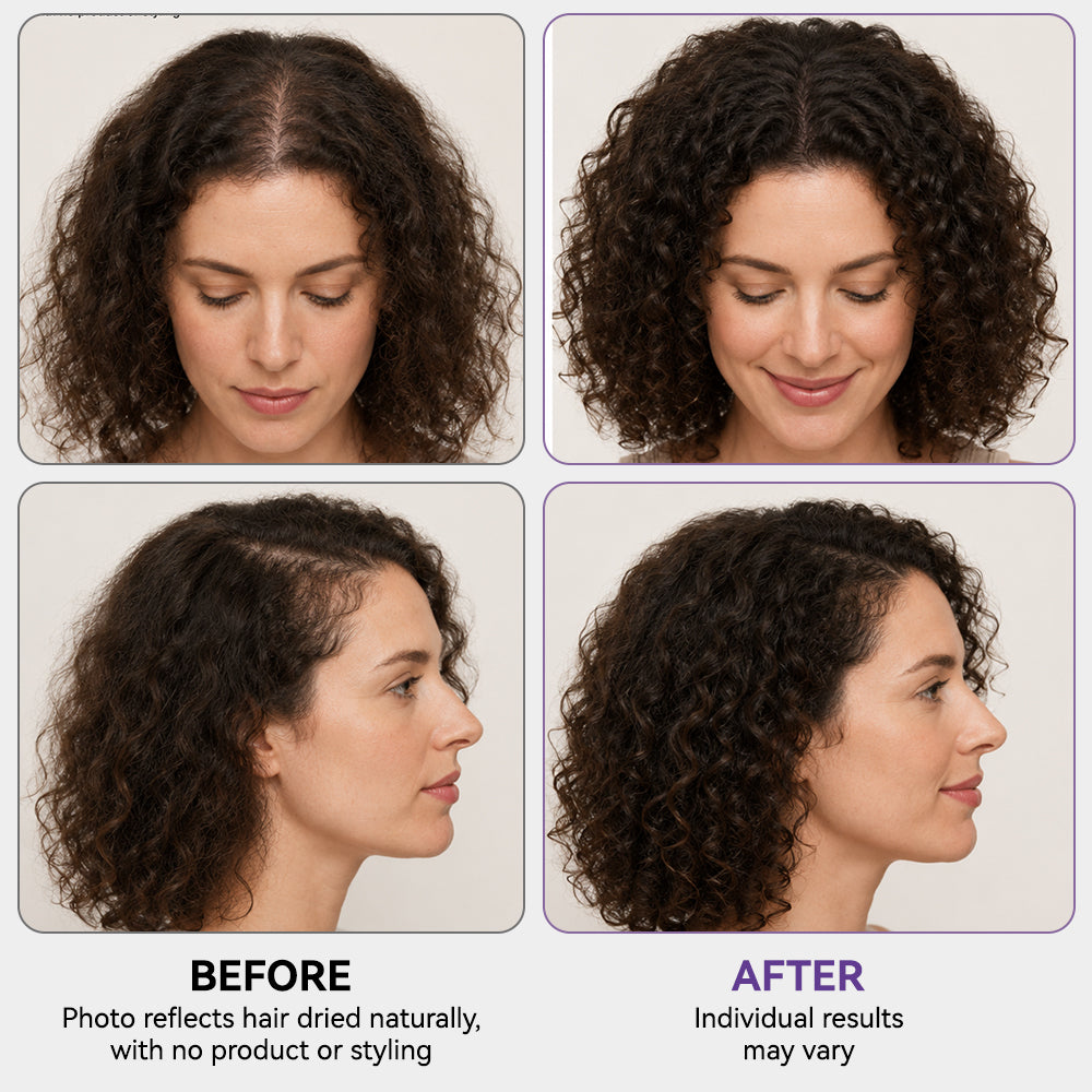 Hair Care Essence for Scalp Nourishment